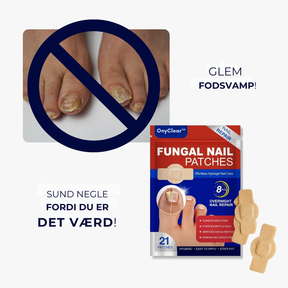 OnyClear™ Therapy Patch - Avanceret pleje for klare og sunde negle.