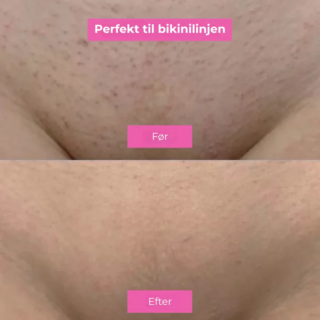 SlowSkin™ | Naturligt Glat Hud Uden en Skraber