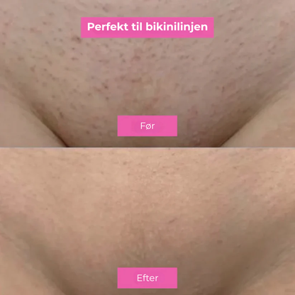 SlowSkin™ | Naturligt Glat Hud Uden en Skraber