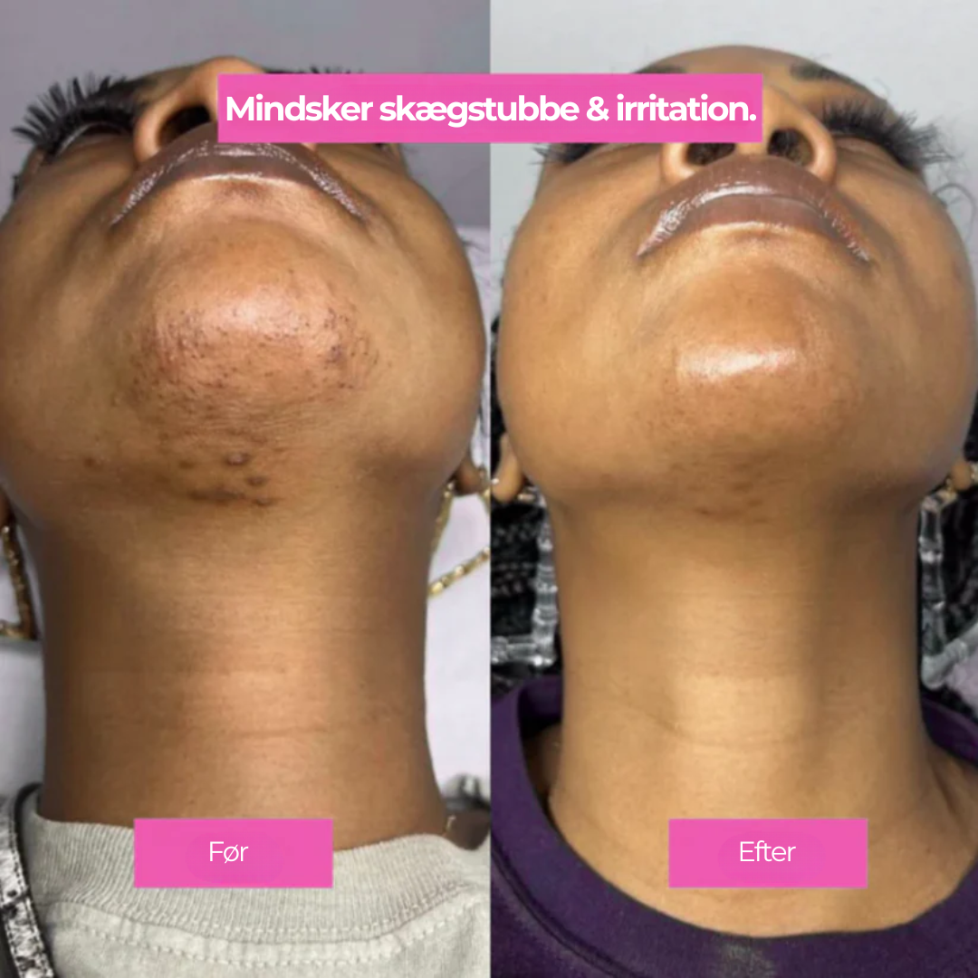 SlowSkin™ | Naturligt Glat Hud Uden en Skraber