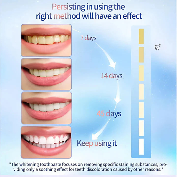 WhiteningToothpaste, Niacinamide Whitening og pletfjernende tandpasta